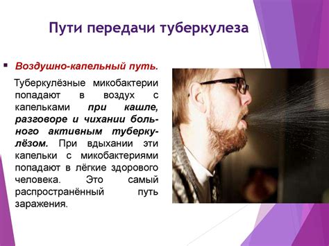 Туберкулез легких. Симптомы, выявление, профилактика - презентация онлайн