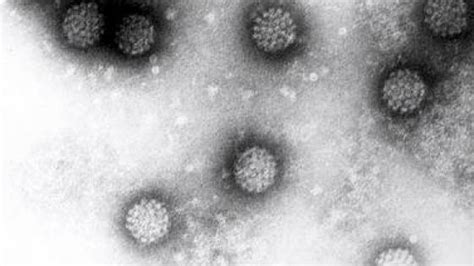 Tumori della gola, 1600 casi l'anno per colpa dell'Hpv - la Repubblica