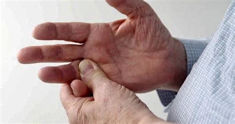 К чему чешется безымянный палец на правой или левой руке: толкование ...