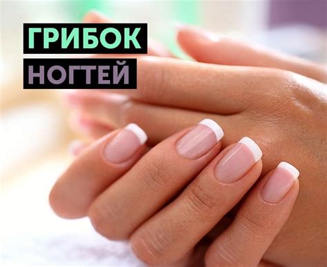 средство от грибка ногтя на руках - uniformcustomize