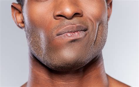 Six Signs You Might Have a Dry Socket » Scary Symptoms