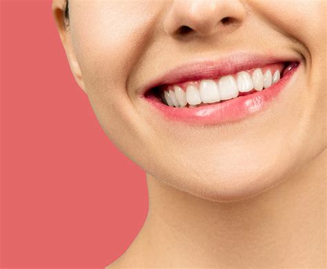 Hollywood Smile - THS Turkish Health Service