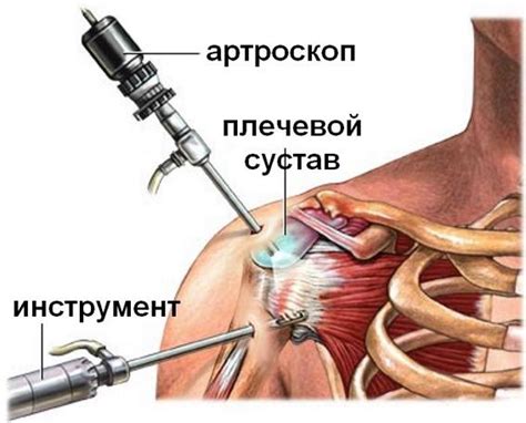 Лечение боли в плечевом суставе - Клиника Здоровье 365 г. Екатеринбург
