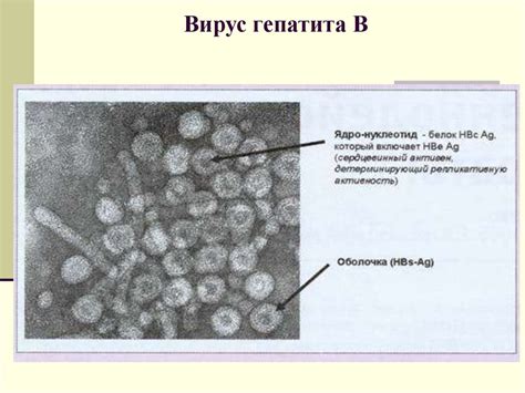 Вирусные гепатиты - презентация онлайн