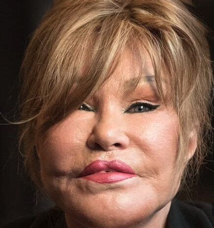 Phun Forum Celebrity Extra: The Truth About Celebrity Plastic Surgery! - 42q69h7