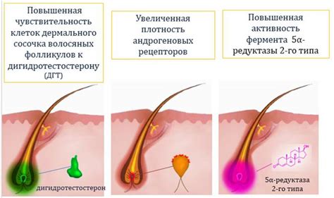Андрогенетическая алопеция. Update :: Овчаренко Юлия