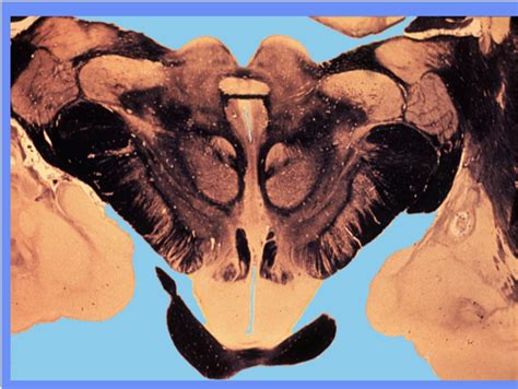 Human- important structures Diagram | Quizlet