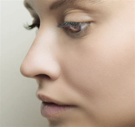 tips  minimize bruising  injectables  flawless atlanta