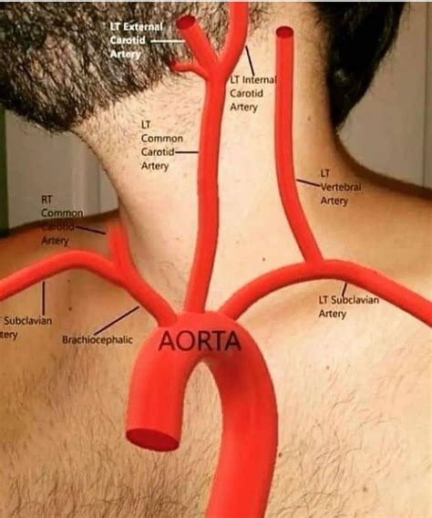 Aorta - MEDizzy