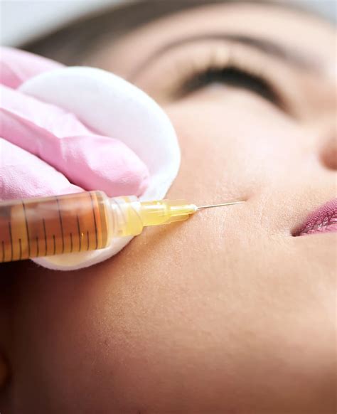 Face PRP - The Aesthetics Clinic by Dr Shaista Lodhi | Skin, Hair, and ...