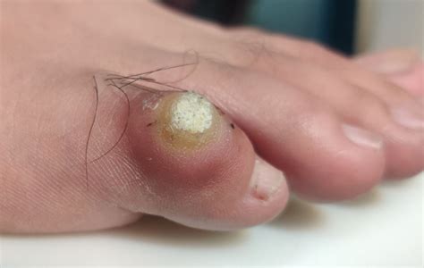 corn  baby foot  jennifer vidal blog