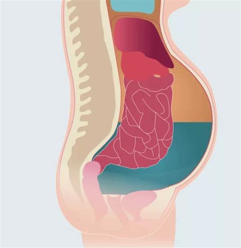 Причини, сиптоми, лечение при асцит — Medconsult.bg