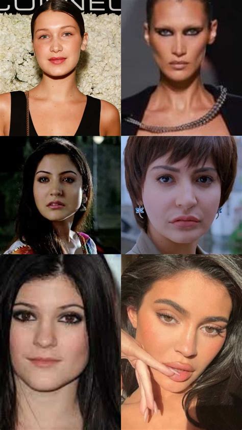 celebrity plastic surgery     images