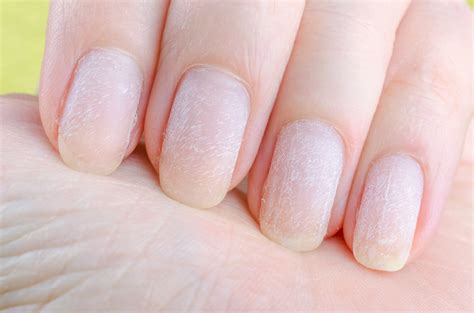 Diferencias entre acetona y quitaesmalte | Salud180