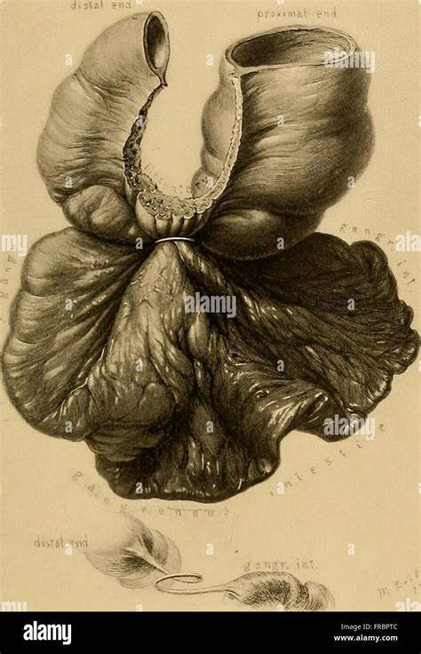 Operative gynecology (1898 Stock Photo - Alamy