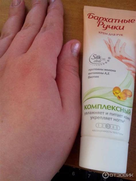 Чем лечить сухую кожу рук с трещинами в домашних условиях