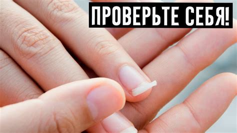 Если у вас слоятся и ломаются ногти, то организм умоляет о помощи ...