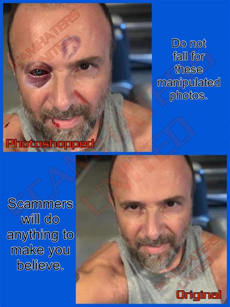 Fake photos of injuries are created to... - ScamHaters United