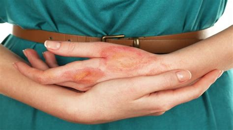 Анетодермия: что происходит с кожей? | MedAboutMe