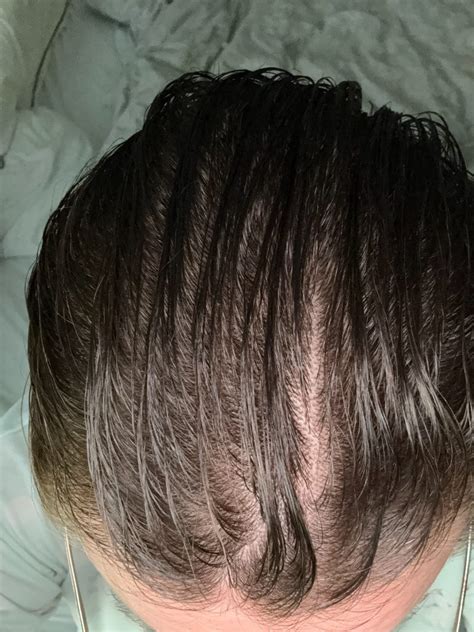 Batana Oil Reviews & Before and After - Batana Oil, Australia