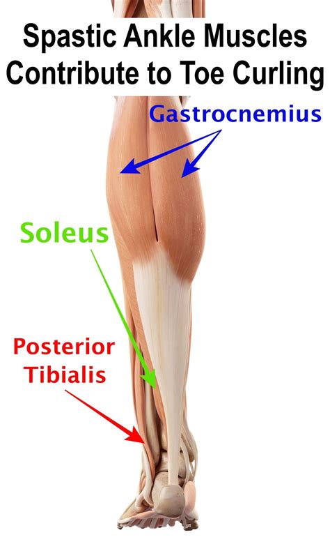 how to fix curled toes