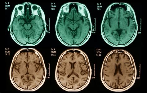 groundbreaking neuroscience study finds striking similarities  brains
