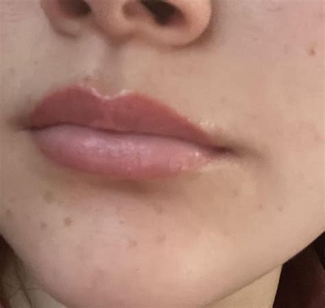 lip tattoo uneven fading rpmuandmicroblading