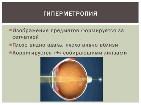 Гиперметропия, амблиопия, астигматизм. Методы лечения, техника ...