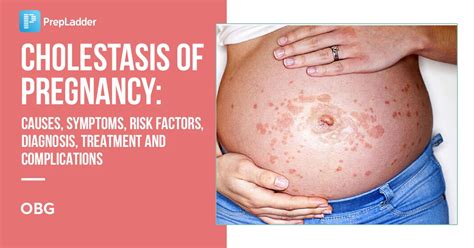 Cholestasis of Pregnancy: Causes, Symptoms and Treatment
