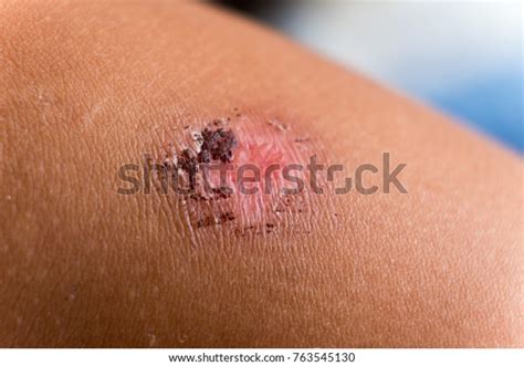 Crust skin : 13 102 images, photos et images vectorielles de stock ...