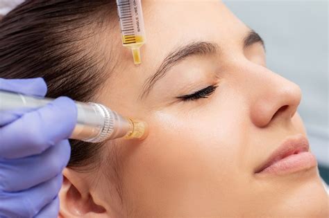 Коллагенно-стимулирующая терапия - STELLAR BEAUTY CLINIC