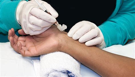 ultrasound guided vascular access  ultrasound training