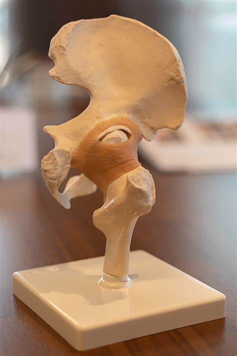 Hip Surgery – Prof. Dr. Burak Akan
