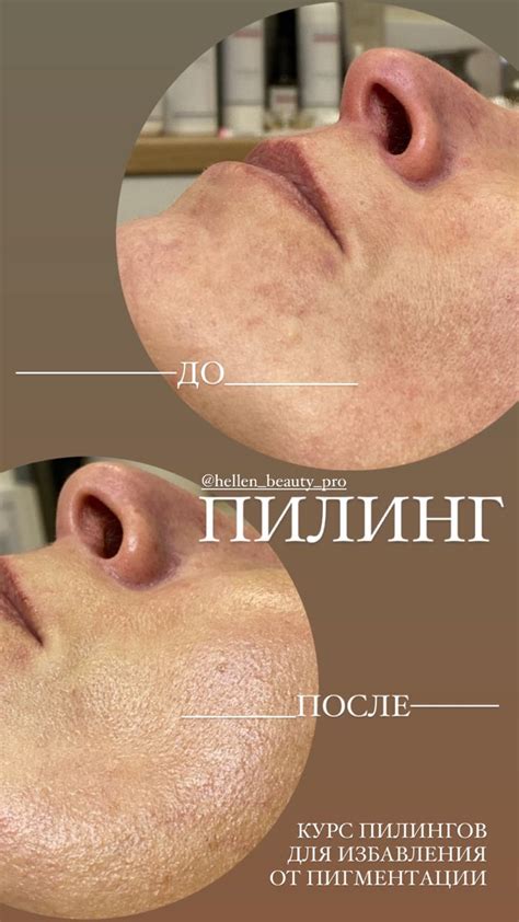 Косметология в 2024 г | Косметология, Косметолог, Лицо