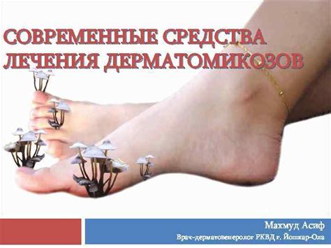 СОВРЕМЕННЫЕ СРЕДСТВА ЛЕЧЕНИЯ ДЕРМАТОМИКОЗОВ Махмуд Асиф Врач ...