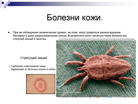 Чесотка. Лечение чесотки в домашних условиях — Balabolkina.Ru