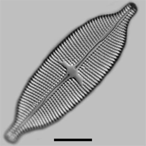 Aneumastus | Genera - Diatoms of North America