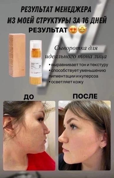 СЫВОРОТКА ОТ ПИГМЕНТАЦИИ NL ♥♥ Настоятельно рекомендую! 﫶 Очень многим ...