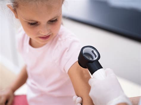 Pediatric Dermatology - Academic Alliance in Dermatology