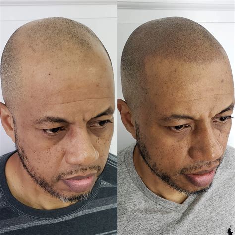 Scalp tattoos will soon change how we view classic bald hairstyles 23