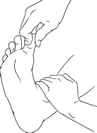 exercise  claw toe deformity physical therapy