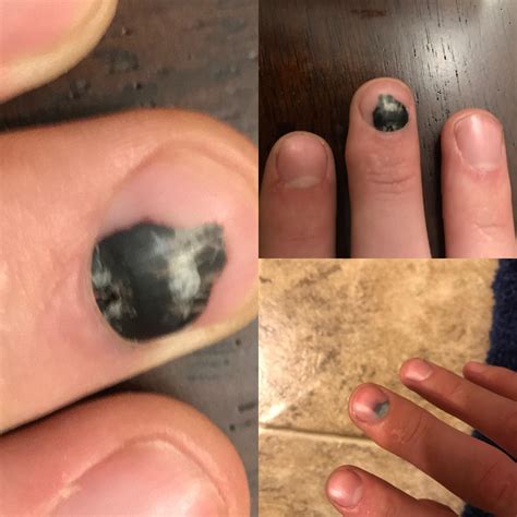 113 best Neosporin images on Pholder | Skincare Addiction, Medical and Mildlyinteresting