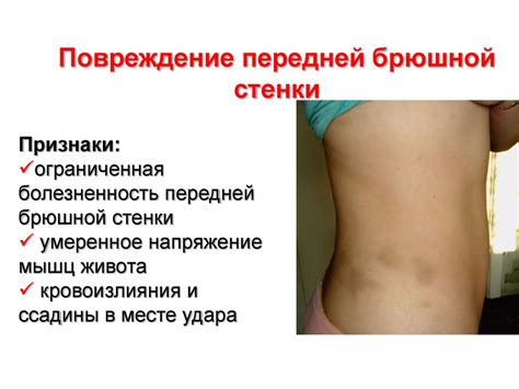 Травма живота - презентация онлайн