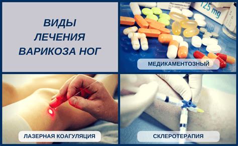 Прессотерапия при варикозе вен на ногах: можно ли делать