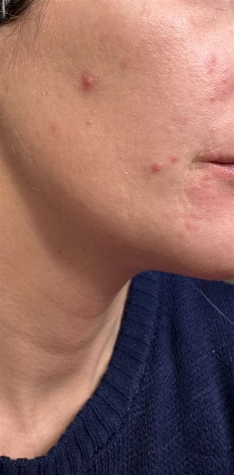 Help with my gross skin! : r/30PlusSkinCare
