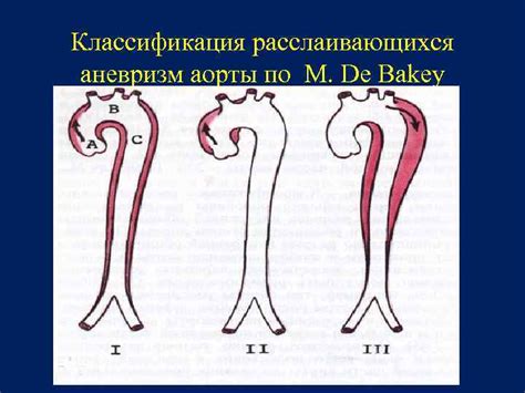 Аневризмы аорты Кафедра факультетской хирургии ГБОУ ВПО АГМА