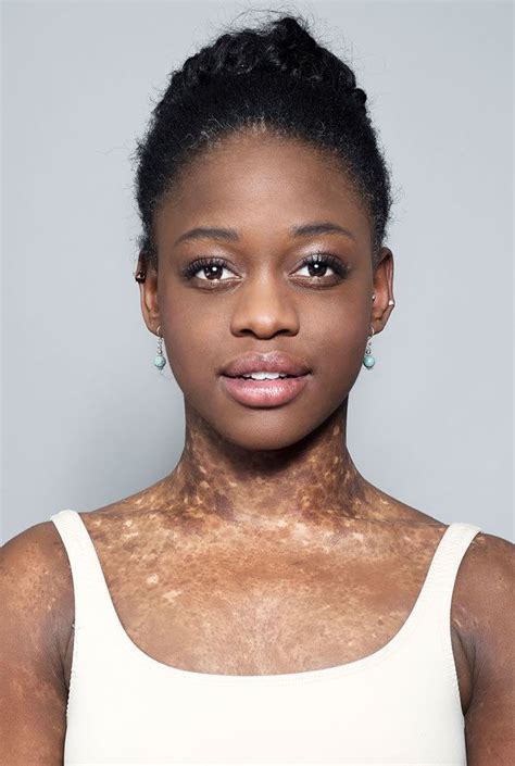 Michaela DePrince - Alchetron, The Free Social Encyclopedia
