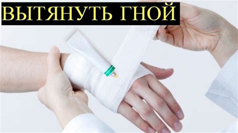 Недорогие Мази, которые Помогут вытянуть Гной при Фурункулёзе, Нарывах ...