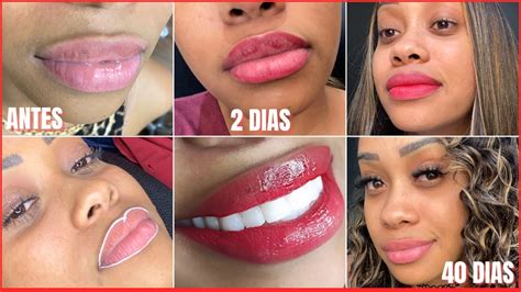 Quanto Tempo Dura A Micropigmentação - Fases Da Micropigmentação Labial - BRAINCP