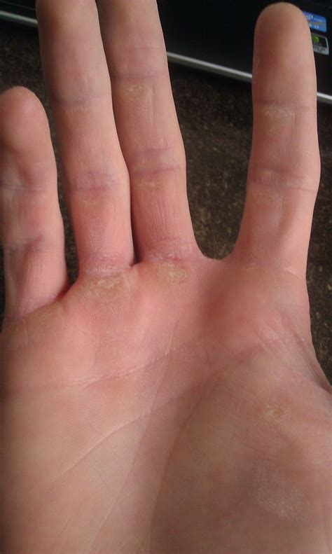 Show off your hands! : r/bodybuilding